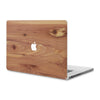  MacBook Pro 17" — #WoodBack Skin - Cover-Up - 1